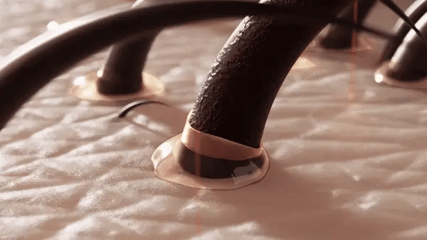 CuirCheveux – Peigne Électrique pour la Santé du Cuir Chevelu - Rynova