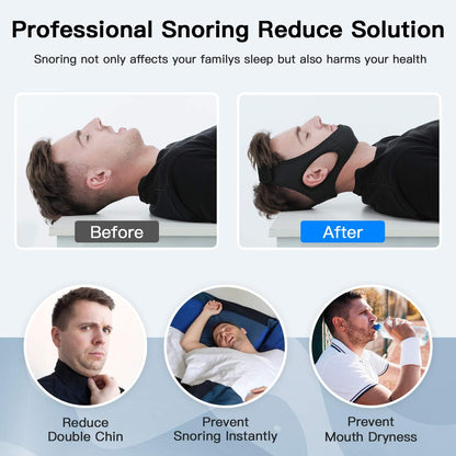 Bande Anti-Ronflement pour Apnée du Sommeil – Solution Efficace et Confortable - Rynova