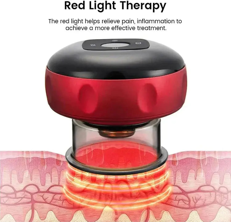 CuppRelax - Appareil de Massage Intelligent avec Ventouses - Rynova