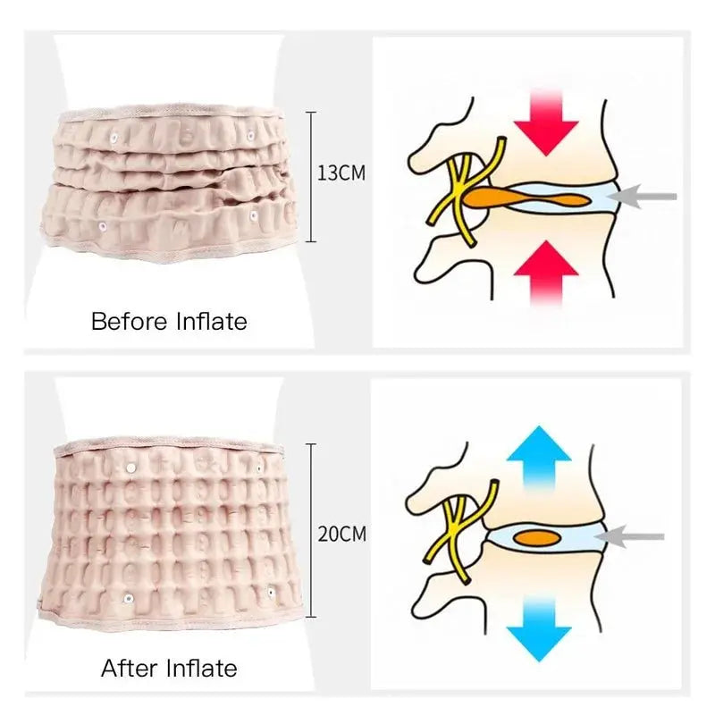 ErgoBelt - Ceinture de Soulagement des Douleurs Lombaires - Rynova