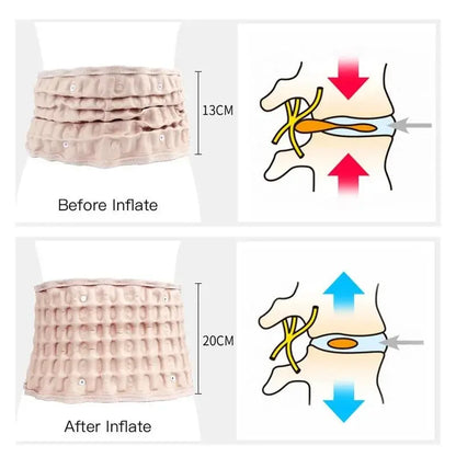 ErgoBelt - Ceinture de Soulagement des Douleurs Lombaires - Rynova
