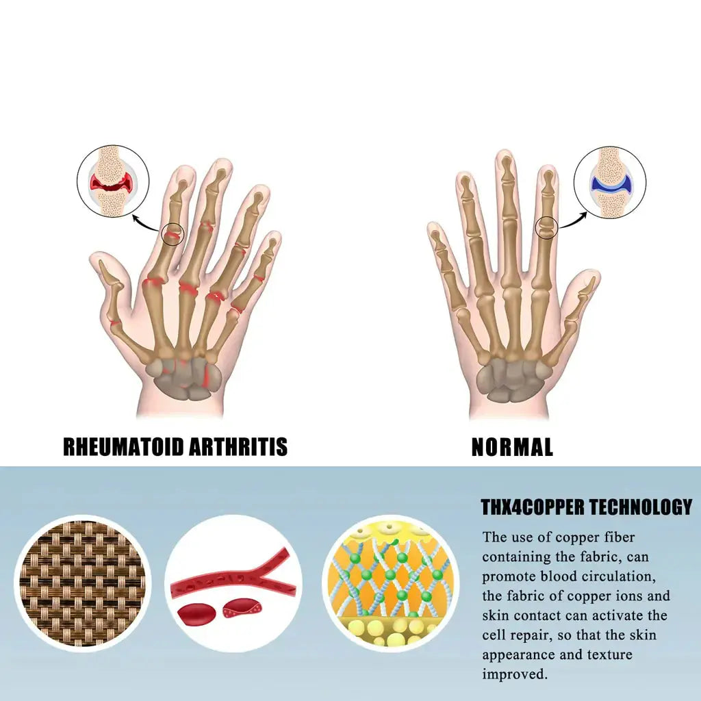 OrthoSouplesse - Gants de Compression Arthrite pour un Soulagement Confortable - Rynova